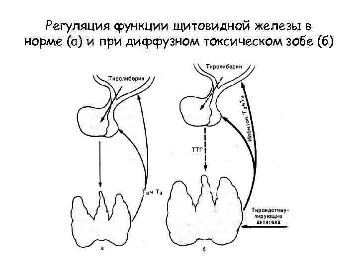 Регуляция функции щитовидной железы в норме (а) и при диффузном токсическом зобе (б) 