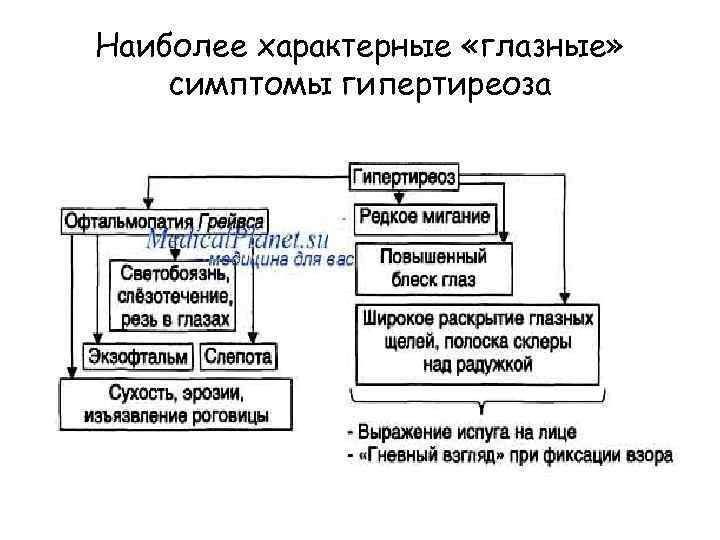 Наиболее характерные «глазные» симптомы гипертиреоза 