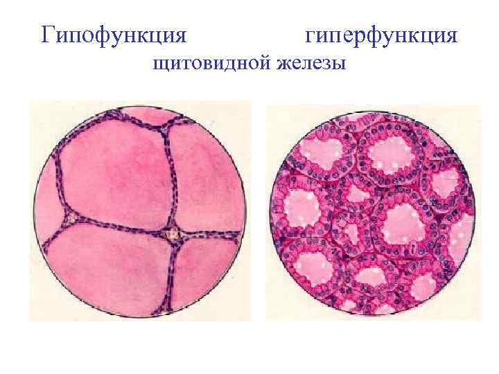 Гипофункция гиперфункция щитовидной железы 