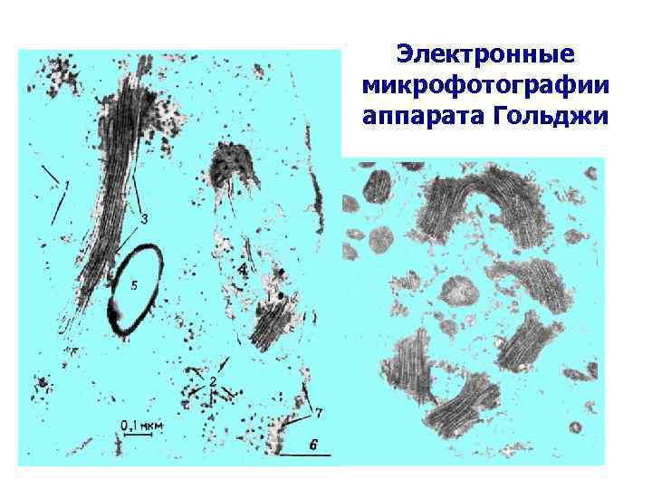 Электронные микрофотографии аппарата Гольджи 