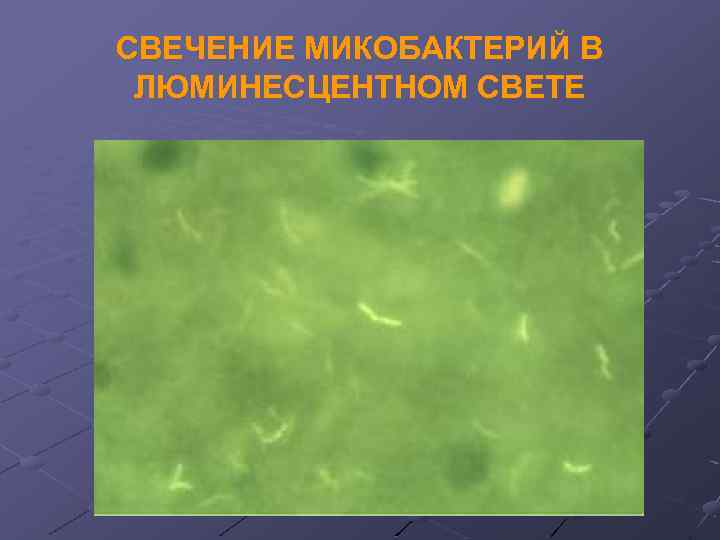 СВЕЧЕНИЕ МИКОБАКТЕРИЙ В ЛЮМИНЕСЦЕНТНОМ СВЕТЕ 