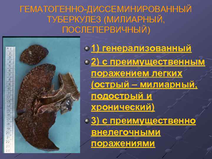 ГЕМАТОГЕННО-ДИССЕМИНИРОВАННЫЙ ТУБЕРКУЛЕЗ (МИЛИАРНЫЙ, ПОСЛЕПЕРВИЧНЫЙ) 1) генерализованный 2) с преимущественным поражением легких (острый – милиарный,
