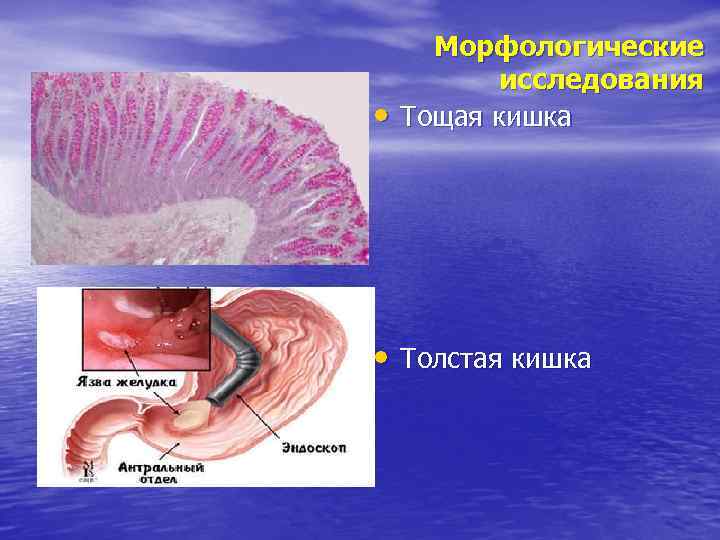  • Морфологические исследования Тощая кишка • Толстая кишка 