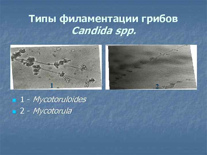 Типы филаментации грибов Candida spp. 1 n n 1 - Mycotoruloides 2 - Mycotorula