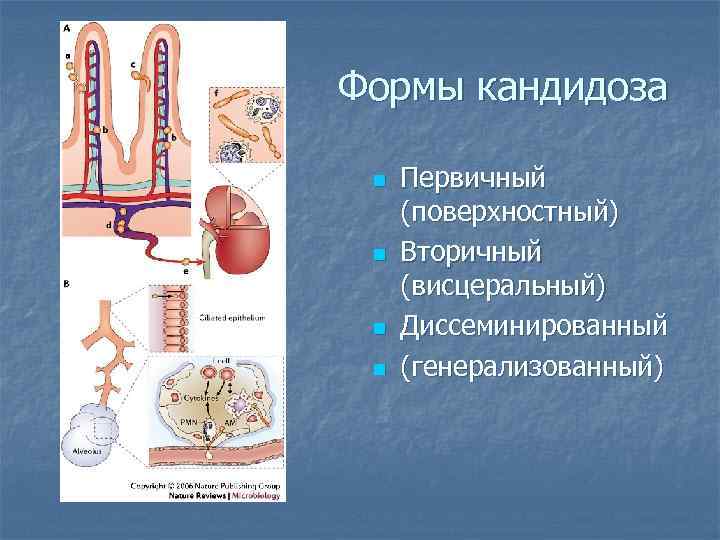 Формы кандидоза n n Первичный (поверхностный) Вторичный (висцеральный) Диссеминированный (генерализованный) 