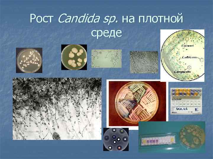 Рост Сandida sp. на плотной среде 