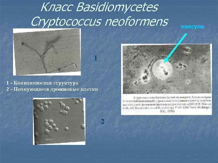 Класс Basidiomycetes Cryptococcus neoformens 1 1 - Конидиеносная структура 2 - Почкующиеся дрожжевые клетки