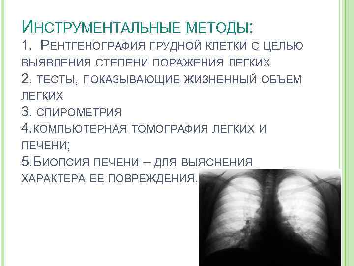 ИНСТРУМЕНТАЛЬНЫЕ МЕТОДЫ: 1. РЕНТГЕНОГРАФИЯ ГРУДНОЙ КЛЕТКИ С ЦЕЛЬЮ ВЫЯВЛЕНИЯ СТЕПЕНИ ПОРАЖЕНИЯ ЛЕГКИХ 2. ТЕСТЫ,