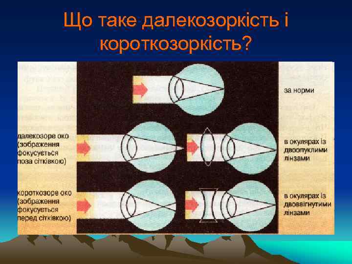Що таке далекозоркість і короткозоркість? 