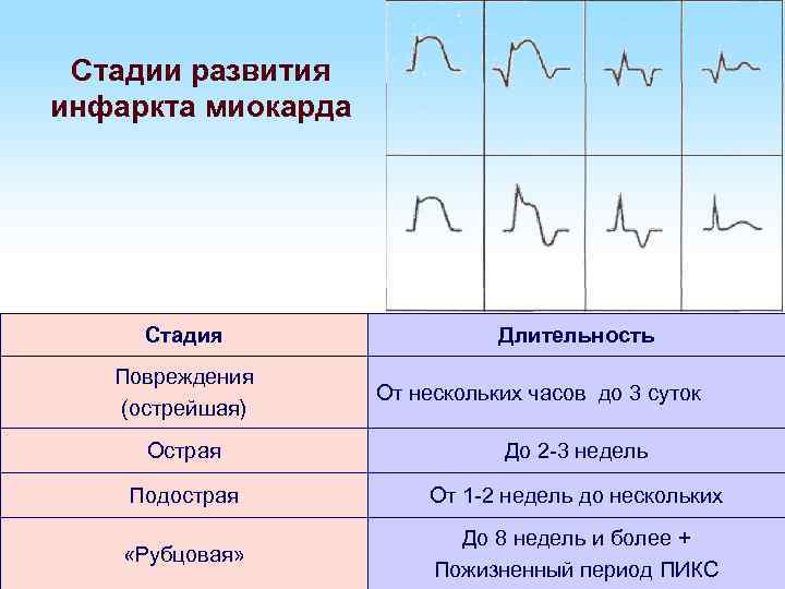 Инфаркт миокарда степени