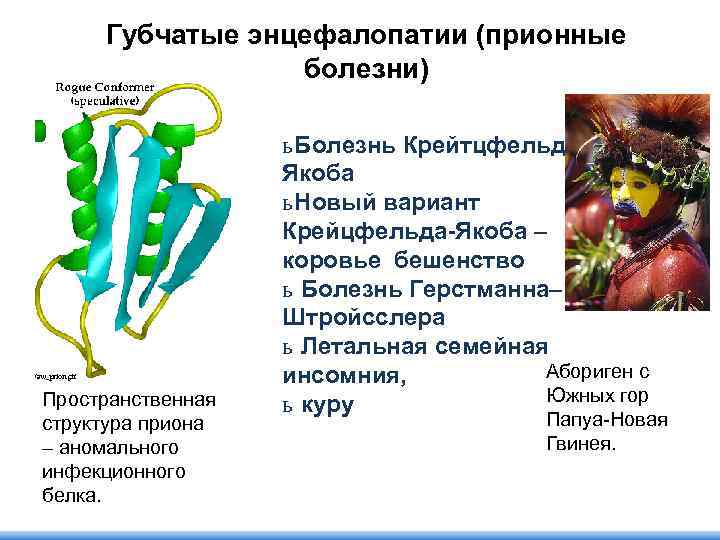 Губчатые энцефалопатии (прионные болезни) Пространственная структура приона – аномального инфекционного белка. ь Болезнь Крейтцфельда.