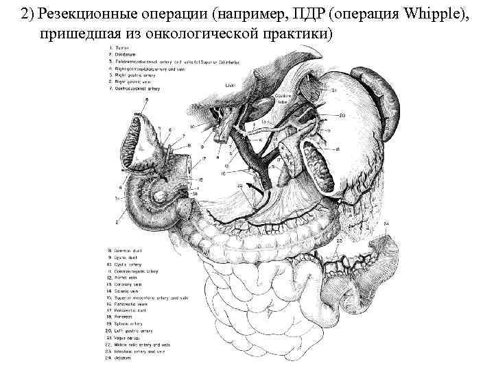 Характер стула при хроническом панкреатите