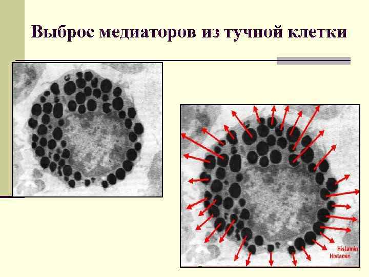 Выброс медиаторов из тучной клетки 