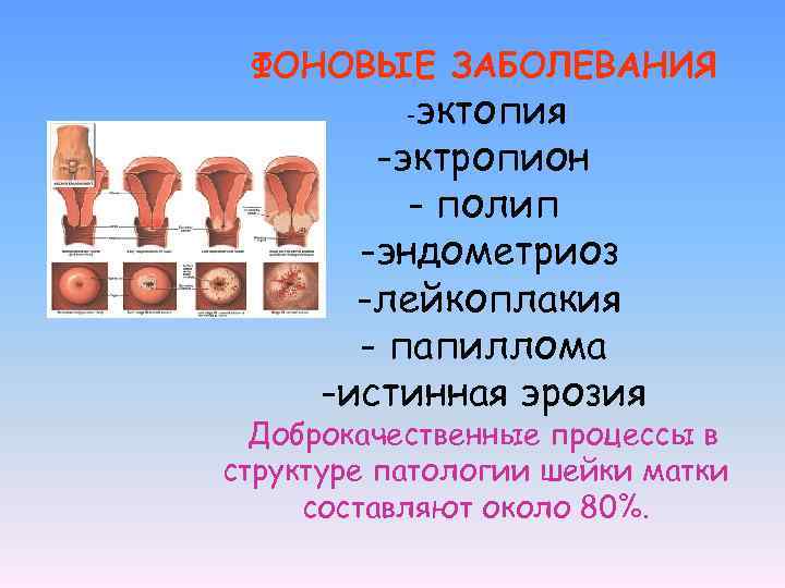 Шейка цилиндрической формы