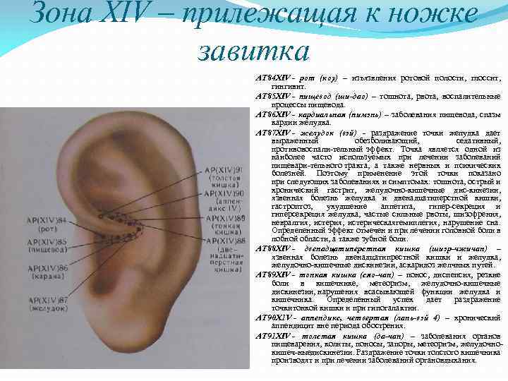 Зона XIV – прилежащая к ножке завитка AT 84 XIV - рот (коу) –