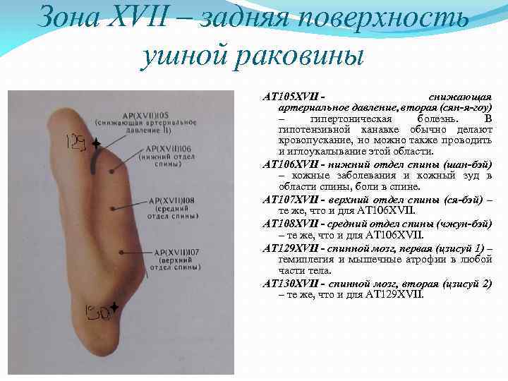 Зона XVII – задняя поверхность ушной раковины AT 105 XVII - снижающая артериальное давление,