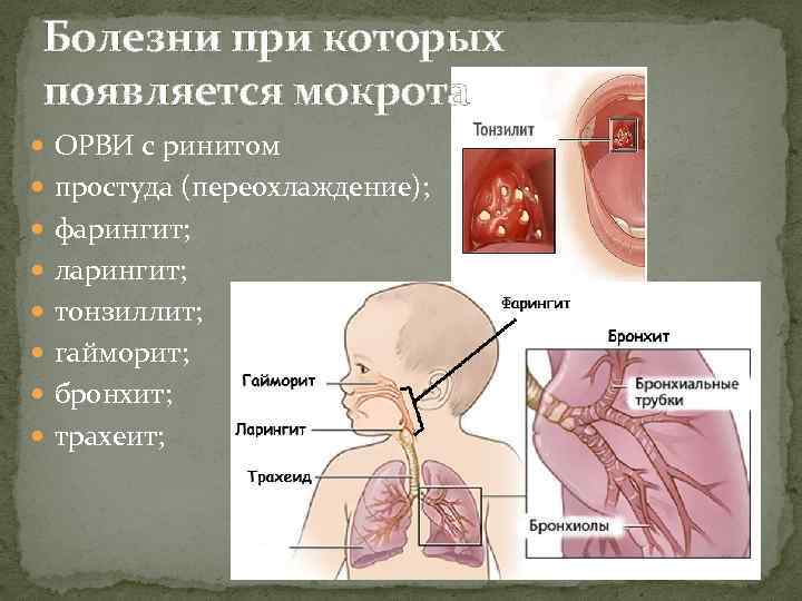 Болезни при которых появляется мокрота ОРВИ с ринитом простуда (переохлаждение); фарингит; ларингит; тонзиллит; гайморит;