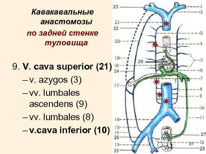 Кава портальные анастомозы. Порто-кава-кавальный анастомоз схема. Портокавальные и кавакавальные анастомозы анатомия. Порто кавальные и кава кавальные анастомозы анатомия. Задний кава кавальный анастомоз.