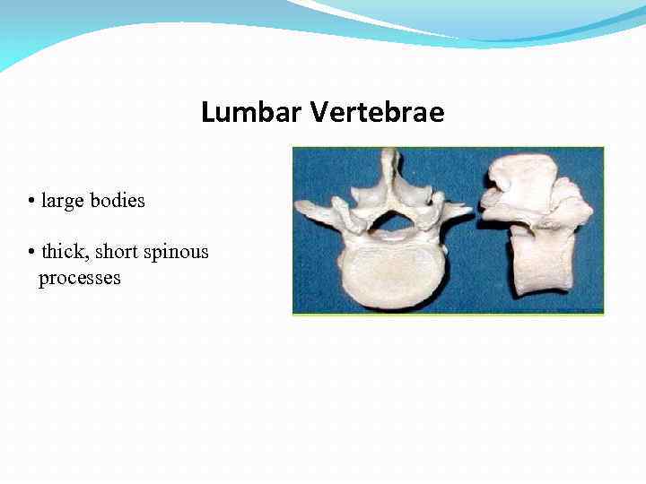 Lumbar Vertebrae • large bodies • thick, short spinous processes 
