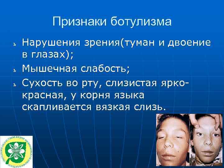 Инкубационный период ботулизма у человека. Характерный клинический симптом ботулизма. Клинические проявления ботулизма. Основные проявления ботулизма. Симптомы при ботулизме основные.