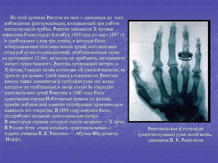 По этой причине Рентген не знал о сделанных до него наблюдении флюоресценции, возникающей при