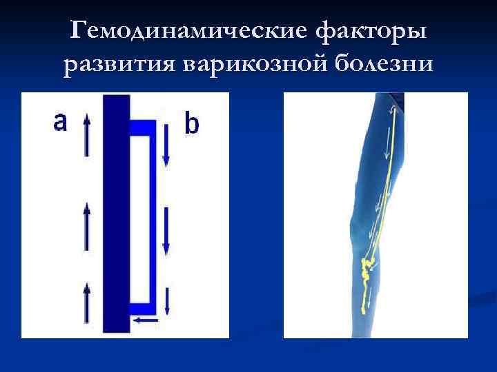 Гемодинамические факторы развития варикозной болезни 