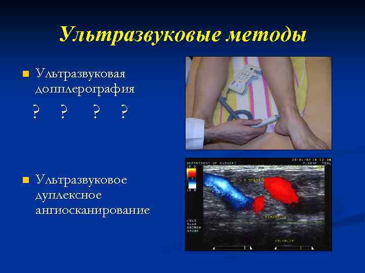 Ультразвуковые методы n Ультразвуковая допплерография ? ? n ? ? Ультразвуковое дуплексное ангиосканирование 