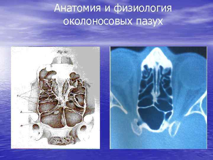 Анатомия и физиология околоносовых пазух 