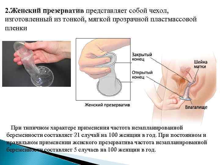 2. Женский презерватив представляет собой чехол, изготовленный из тонкой, мягкой прозрачной пластмассовой пленки При