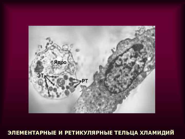 ЭЛЕМЕНТАРНЫЕ И РЕТИКУЛЯРНЫЕ ТЕЛЬЦА ХЛАМИДИЙ 