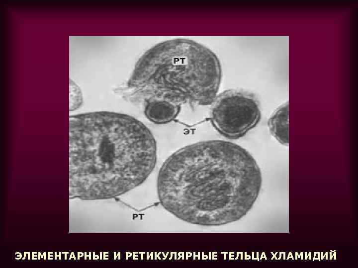 ЭЛЕМЕНТАРНЫЕ И РЕТИКУЛЯРНЫЕ ТЕЛЬЦА ХЛАМИДИЙ 