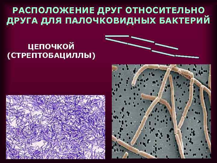 РАСПОЛОЖЕНИЕ ДРУГ ОТНОСИТЕЛЬНО ДРУГА ДЛЯ ПАЛОЧКОВИДНЫХ БАКТЕРИЙ ЦЕПОЧКОЙ (СТРЕПТОБАЦИЛЛЫ) 