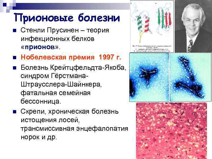 Прионовые болезни n n Стенли Прусинен – теория инфекционных белков «прионов» . Нобелевская премия