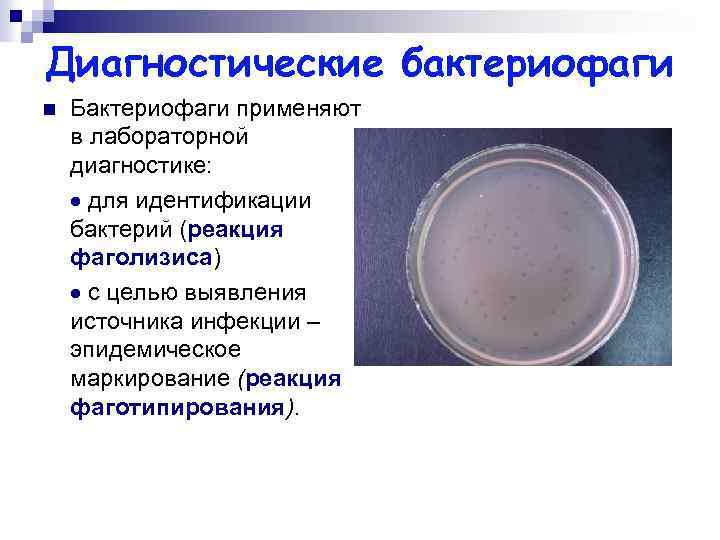 Чувствительность к бактериофагам. Диагностические бактериофаги. Диагностические бактериофаги применяются для. Реакция фаголизиса микробиология. Фаготипирование бактерий микробиология.