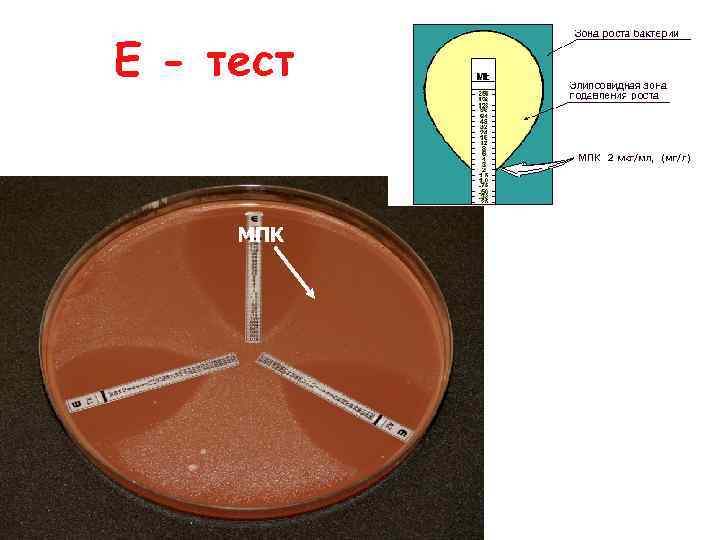 Е - тест МПК 