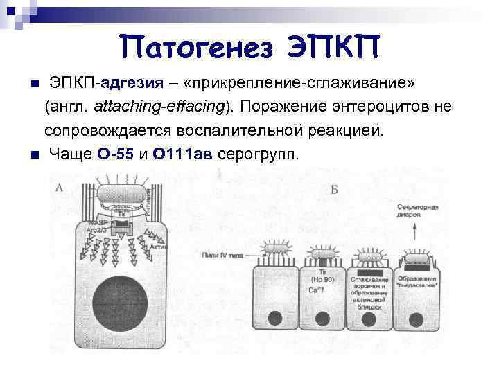 Патогенез ЭПКП-адгезия – «прикрепление-сглаживание» (англ. attaching-effacing). Поражение энтероцитов не сопровождается воспалительной реакцией. n Чаще