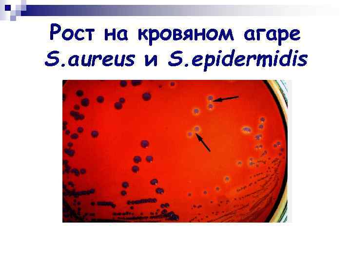 Рост на кровяном агаре S. aureus и S. epidermidis 