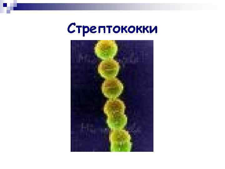Стрептококки 