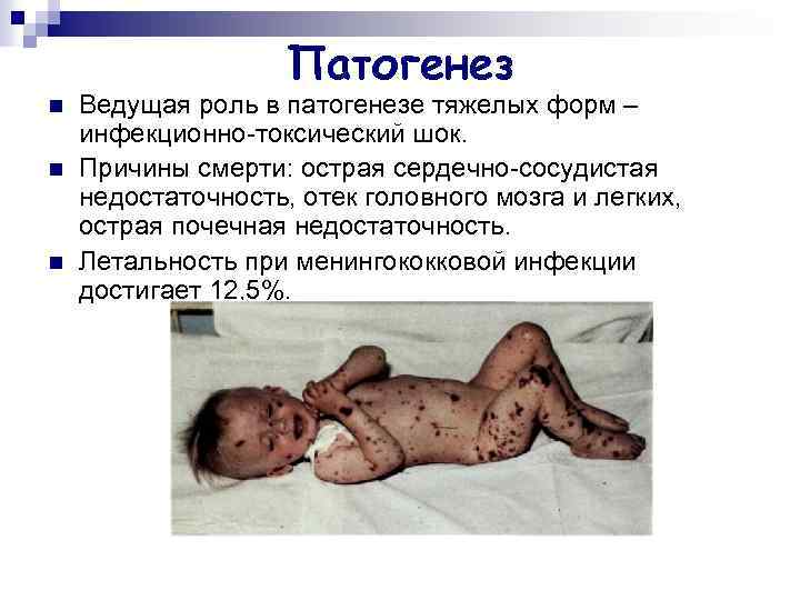 Патогенез n n n Ведущая роль в патогенезе тяжелых форм – инфекционно-токсический шок. Причины