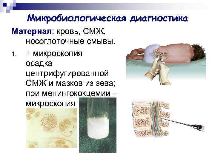 Микробиологическая диагностика Материал: кровь, СМЖ, носоглоточные смывы. 1. + микроскопия осадка центрифугированной СМЖ и