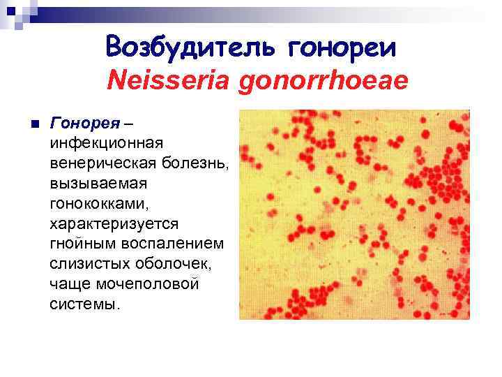 Возбудитель гонореи Neisseria gonorrhoeae n Гонорея – инфекционная венерическая болезнь, вызываемая гонококками, характеризуется гнойным