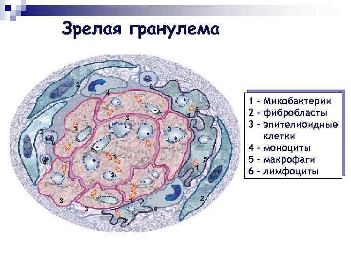 Зрелая гранулема 2 6 4 1 3 1 2 5 3 6 1 6