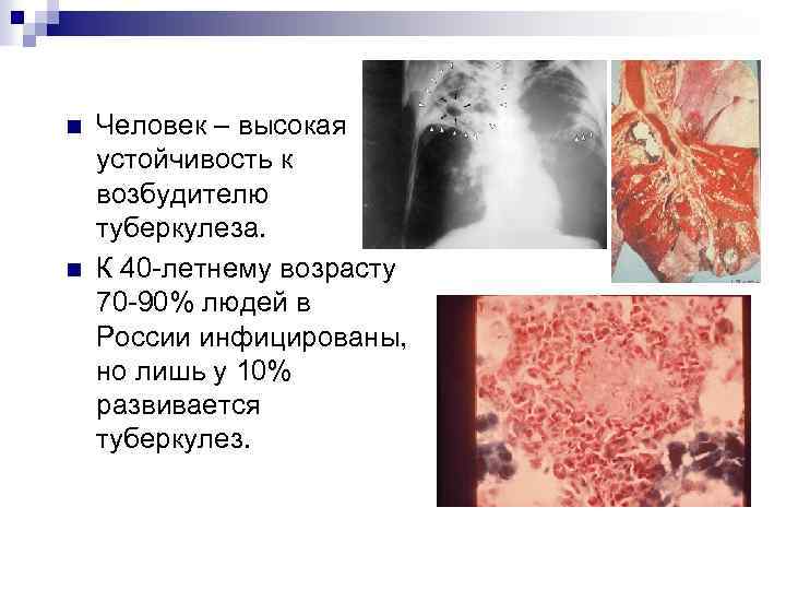 n n Человек – высокая устойчивость к возбудителю туберкулеза. К 40 -летнему возрасту 70
