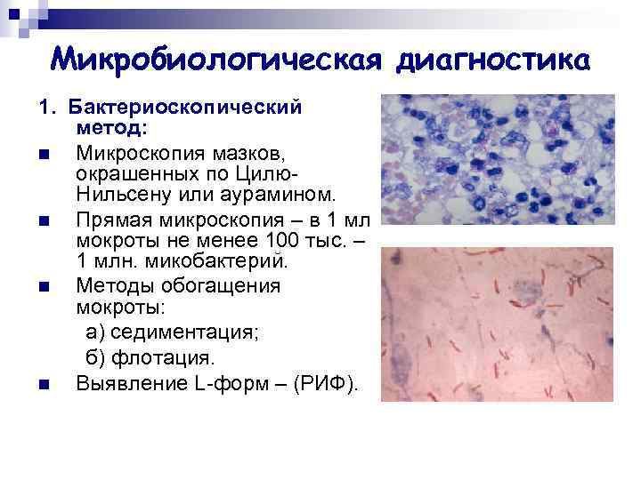 Микробиологическая диагностика 1. Бактериоскопический метод: n Микроскопия мазков, окрашенных по Цилю. Нильсену или аурамином.