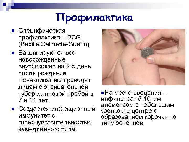 Профилактика n n n Специфическая профилактика – BCG (Bacille Calmette-Guerin), Вакцинируются все новорожденные внутрикожно