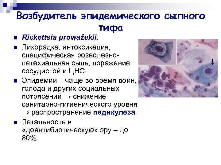 Возбудитель эпидемического сыпного тифа n n Rickettsia prowažekii. Лихорадка, интоксикация, специфическая розеолезнопетехиальная сыпь, поражение