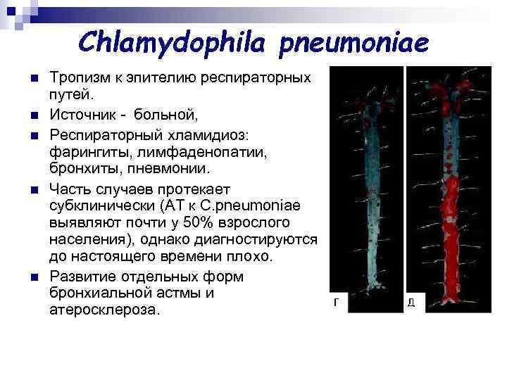 Chlamydophila pneumoniae n n n Тропизм к эпителию респираторных путей. Источник - больной, Респираторный