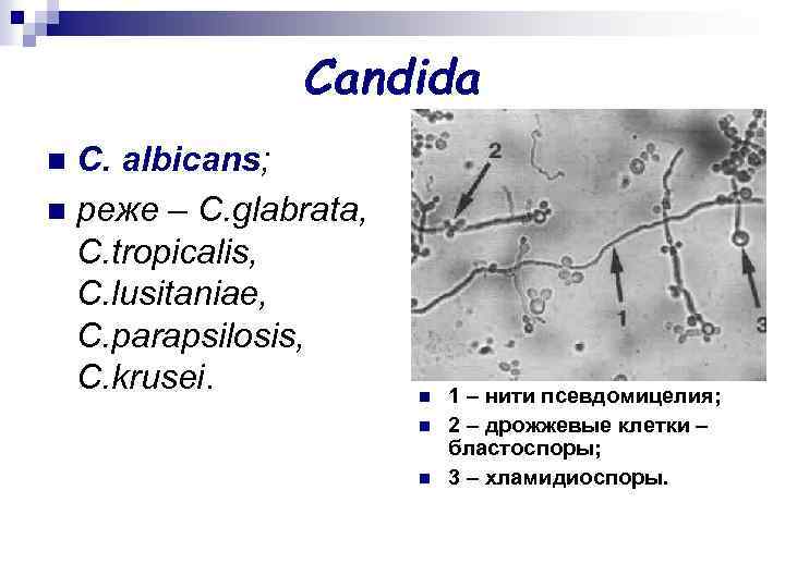 Candida C. аlbicans; n реже – C. glabrata, C. tropicalis, C. lusitaniae, C. parapsilosis,