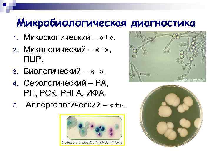 Микробиологическая диагностика 1. 2. 3. 4. 5. Микоскопический – «+» . Микологический – «+»