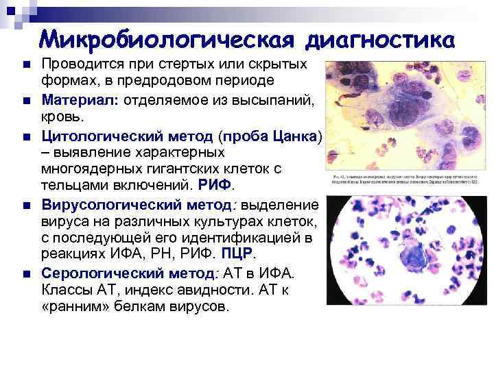 Микробиологическая диагностика n n n Проводится при стертых или скрытых формах, в предродовом периоде